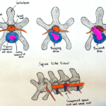 IVDD in Dachshunds – Know This Earlier and Don’t Let It Happen to Your Doxie Friend